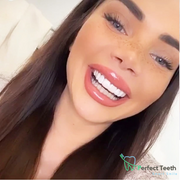 Perfect teeth - Smart smile